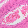 B85, Penis, 40x (H&E)