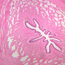 B85, Penis, 2.5x (H&E)