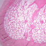 B85, Penis, 1x (H&E)