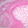 B85, Penis, 1x (H&E)