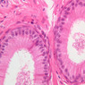 Male