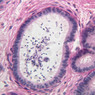 Male