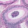 Male