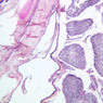 Male