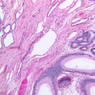Male