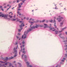 Male