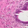 Male