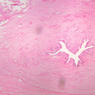 Male