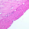 B12, Jejunum, 20x (H&E)
