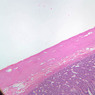 B15, Jejunum, 2.5x (H&E)