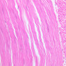 B16, Ileum, 40x (H&E)