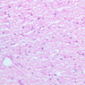 A80, Sciatic Nerve (Cross Section), 20x (H&E)