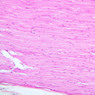A80, Sciatic Nerve (Longitudinal), 10x (H&E)