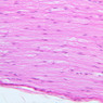 A80, Sciatic Nerve (Longitudinal), 20x (H&E)