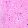A88, Spinal Cord (Longitudinal), 20x (H&E)