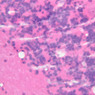 A84, Cerebellum, 40x (H&E)