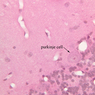 A84, Cerebellum, 40x Labeled (H&E)