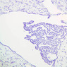 A79, Choroid Plexus, 10x (CV)