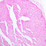 Neural Tissue