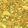 Neural Tissue