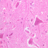 Neural Tissue