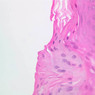 A55, Lip, 40x (H&E)
