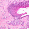 A63, Tongue, 20x (H&E)