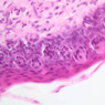 A63, Tongue, 40x (H&E)