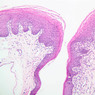 A63, Tongue, 10x (H&E)