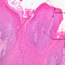 A63, Tongue, 10x Labeled (H&E)