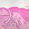 A63, Tongue, 2.5x Labeled (H&E)