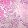 A63, Tongue, 2.5x (H&E)