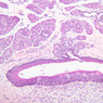 A63, Tongue, 10x (H&E)
