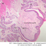 A63, Tongue, 2.5x Labeled (H&E)