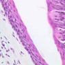 A63, Tongue, 40x (H&E)