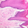 A64, Tongue, 10x (H&E)