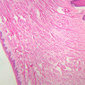 A64, Tongue, 2.5x (H&E)
