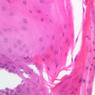 A64, Tongue, 40x (H&E)