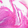 A64, Tongue, 20x (H&E)