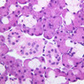 B44, Submandibular Gland, 40x (H&E)