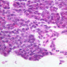 B46, Parotid Gland, 40x (H&E)