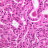 B47, Parotid Gland, 40x (H&E)