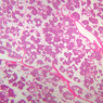 B47, Parotid Gland, 2.5x (H&E)