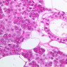 B47, Parotid Gland, 40x (H&E)