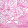 A67, Trachea, 10x (H&E)