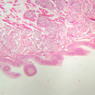 A67, Trachea, 2.5x (H&E)