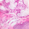 A67, Trachea, 40x (H&E)