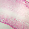 A67, Epiglottis, 2.5x (H&E)