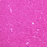 B36, Pancreas, 10x (H&E)