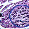 B39, Pancreas, 20x Labeled (Ink/H&E)